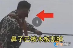 官方辟谣游客玩网红桥被割鼻子 网传信息不属实